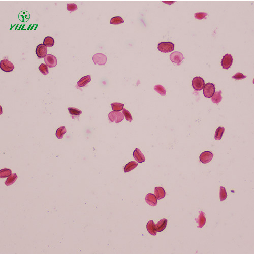 醫(yī)學(xué)蠕蟲線蟲生物顯微切片