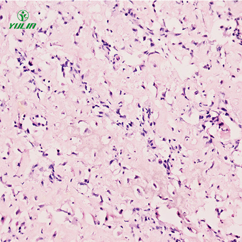 人肌肉骨骼系統(tǒng)疾病標(biāo)本片